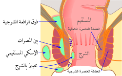 أنواع الخراج الشرجي المستقيمي ومواقعه