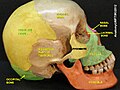 Visión lateral del cráneo, en la que se observa el hueso parietal o, en inglés, parietal bone (en color amarillo).