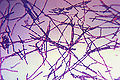 Bacillus antracis