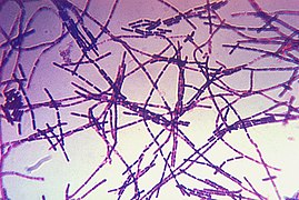 Bacillus anthracis