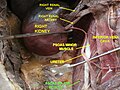 Muscle grand psoas.