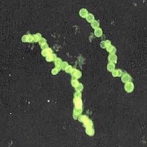 The marine Thiomargarita namibiensis, largest known bacterium