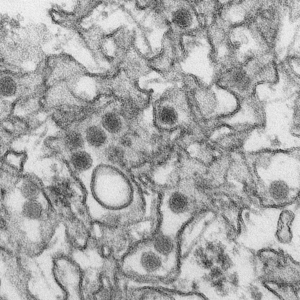 지카 바이러스의 전자 현미경 사진. 바이러스는 지름이 40 nm이며, 외부에 막이 있고, 내부에 짙은 핵이 있다. (출처: CDC)