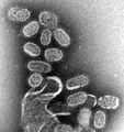 Orthomyxoviridae, los virus de la gripe.