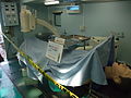 野外手術ユニットの手術台とX線透視装置