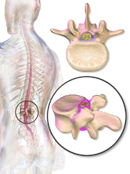 Dura mater of the spine.