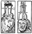 Engraving by Peter Treveris of a trepanation. From Heironymus von Braunschweig's Handywarke of surgeri