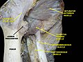 Muscles of thigh. Anterior views.