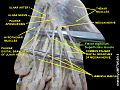 Flexor digitorum superficialis muscle