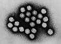 Los adenovirus (Mastadenovirus) causan enfermedad respiratoria, sarpullido, gastroenteritis, cistitis, conjuntivitis, etc.