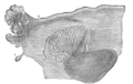Broad ligament of adult, showing epoöphoron