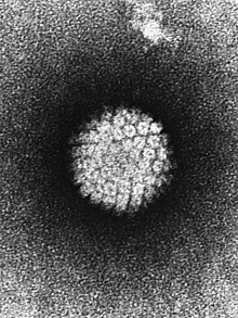 電子顯微鏡下的人類乳突病毒