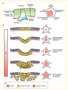 Verschillende graden van epitheel-mesenchymale overgang (EMT) correleren met verschillende weefselmorfologieën