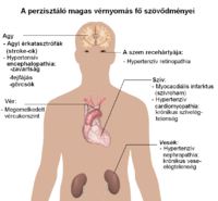 Tartósan magas vérnyomással járó főbb szövődmények szemléltetése