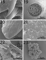 Scanning electron microscopy of Neoandracantha peruensis