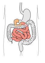 Thumbnail for Small intestine