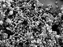 Black and white scan of fungi with small pea-like nodules and stringy material