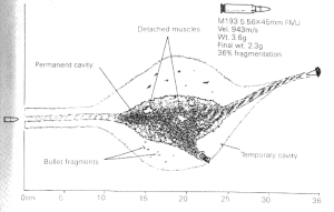 M16 5.56×45mm wound ballistics