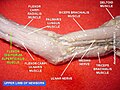 Flexor digitorum superficialis muscle