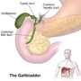 Thumbnail for Gallbladder