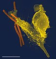 탄저균(주황색)을 포식하는 호중구(노란색) 하나. 주사전자현미경 사진.