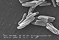 Mycobacterium tuberculosis (Elektronenmikroskop)