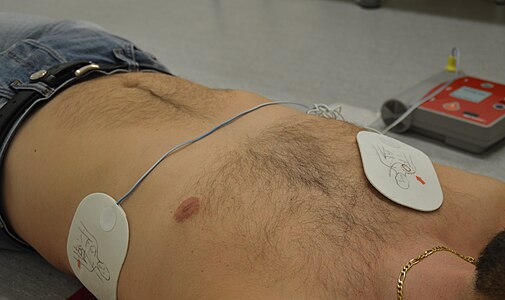 Elektroder til hjertestarter
