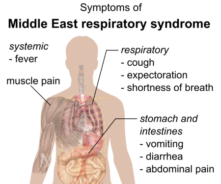 Symptomer på sygdommen MERS[12]