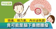 頭痛、視力差、內分泌失調，竟可能是腦下垂體腫瘤！