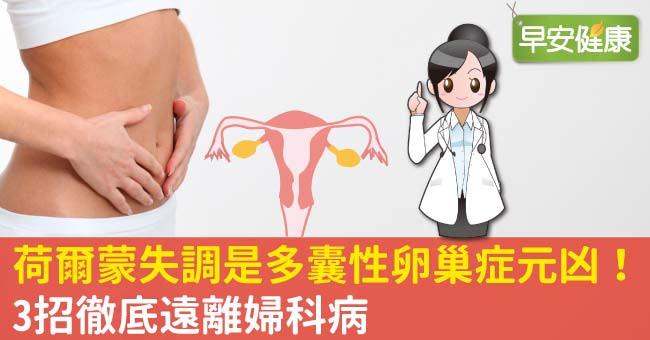 荷爾蒙失調是多囊性卵巢症元凶！3招徹底遠離婦科病