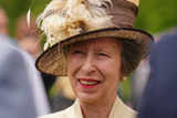 Why Is Princess Anne, King Charles’ Sister Hospitalized? Is the concussion Dangerous?