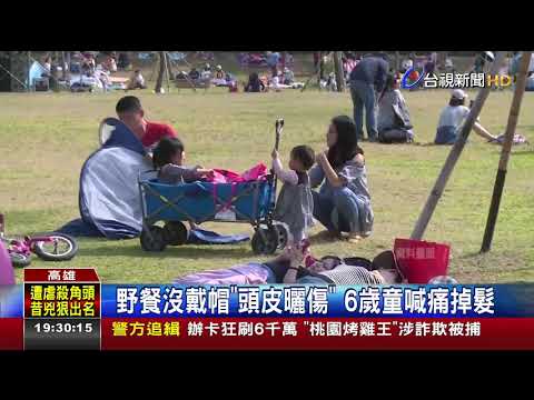 野餐沒戴帽頭皮曬傷6歲童喊痛掉髮