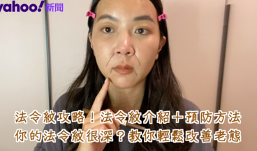 【女生熱話題】避免老態���略 法令紋介紹+預防方法！