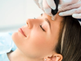 All about Mesotherapy, the French rejuvenation technique