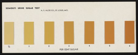 Paper urine sugar pi4m9jy 1 w5yto6v.tiff