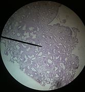 Secretory Endometrium slide.jpg