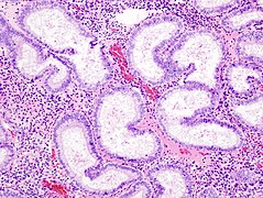 Secretory phase endometrium.jpg