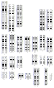 Human karyotype with bands and sub-bands (simple).svg