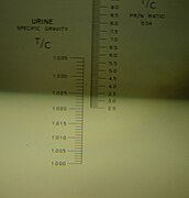 Urine specific gravity.JPG