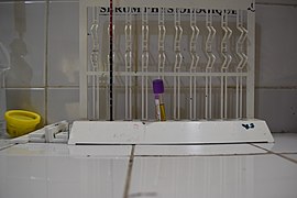 Dispositif VS(Vitesse de segmentation dans un centre santé au Bénin 02.jpg