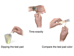 Ketone Urine Test.png