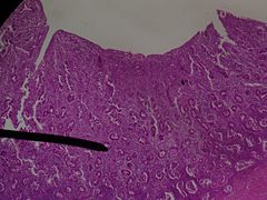 Uterus (endometrium).JPG