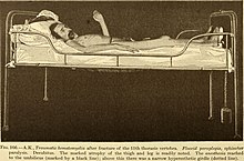 Diseases of the nervous system (1910) (14586639887).jpg