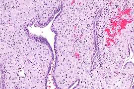 Endometrium with hormone effect -- intermed mag.jpg