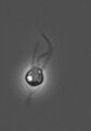 Single Salpingoeca rosetta cell attached to coverslip via theca(100xPhase)