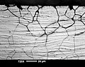 Intergranular corrosion attack in austenitic cold rolled stainless steel sheet.