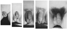 Thumbnail for File:Male genitalia five Tanner stages.png