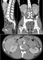 Abdomen and pelvis