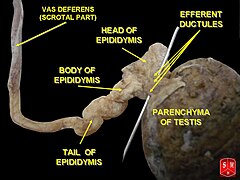 Epididymis 1.jpg