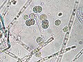 Chroococcus limneticus